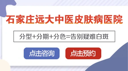 手指发白像是白癜风一样