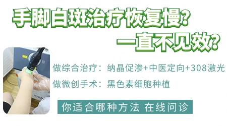 手脚部位的白癜风适合手术还是激光治疗