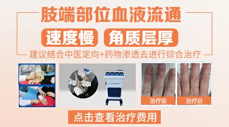 中医能不能看好肢端型白癜风
