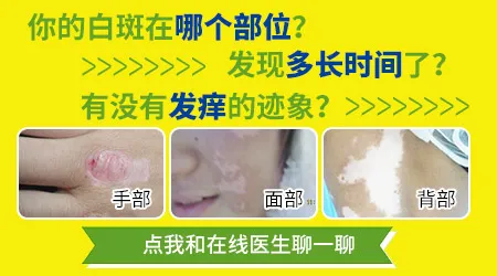 手上有小白点是身体出问题了吗