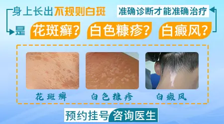 手臂上有不规则的白块怎么回事