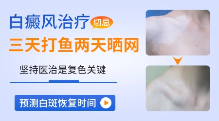 肢端型白癜风光疗到底有没有效果