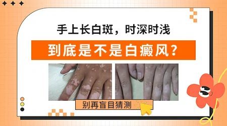 手臂上出现一块较白的皮肤咋回事