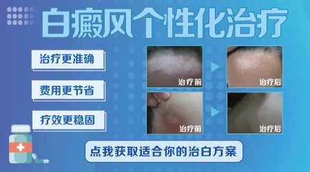 手腕长出边界清晰的白块是什么