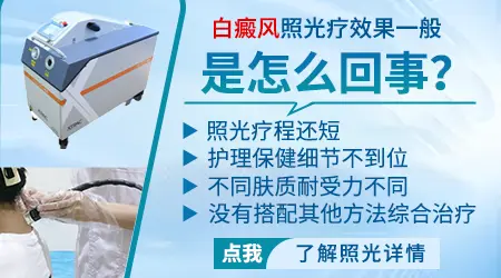 小腿部位的顽固性白癜风光疗能治好吗