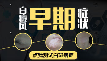 孩子头皮白斑的一块是不是长白癜风了