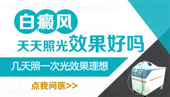 白癜风照308光必须连着照吗 中断几天会有影响吗