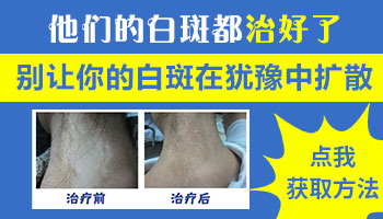 孩子胳膊上白斑有点多治得好吗