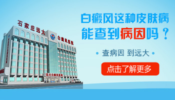 儿童脸部白癜风的常见病因有哪些