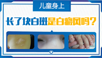 男孩大腿内侧有白斑是白癜风吗