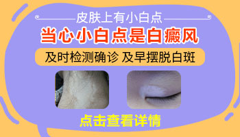 3岁宝宝大腿白一块怎么回事