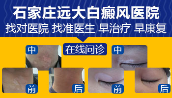 3岁宝宝大腿白一块怎么回事