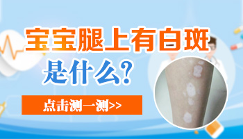 小孩大腿内侧有白斑块