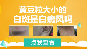 宝宝大腿有个豆粒大小的白斑是什么