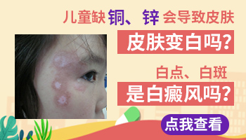 孩子缺锌脸上白斑图片是什么样子