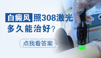 308准分子激光治疗儿童白癜风的费用高不高