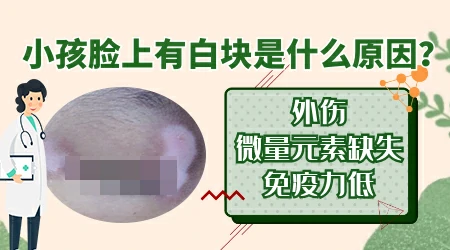 6岁孩子患上了白癜风是什么原因