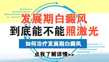 儿童白癜风发展期能照光治疗吗