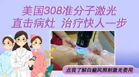 治疗孩子脸上的白癜风可以用308激光仪器吗