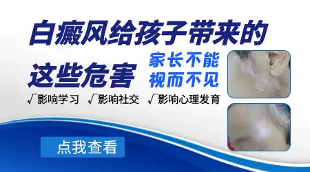 孩子患上白癜风家长应该这样做