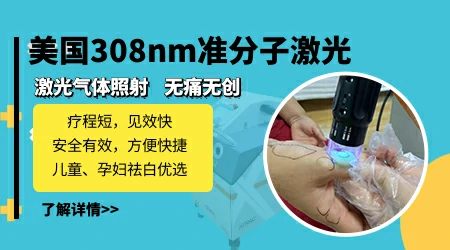 儿童白癜风照308激光治疗后起泡是怎么回事