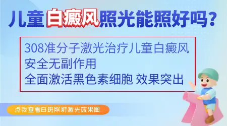 儿童早期白癜风照308激光要多长时间