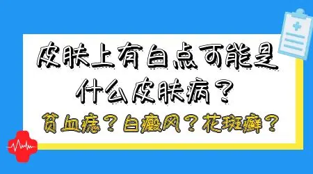 孩子身上白一块是什么病 长白斑原因