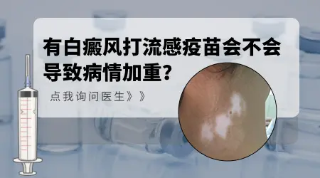 儿童白癜风患者能打流感疫苗吗