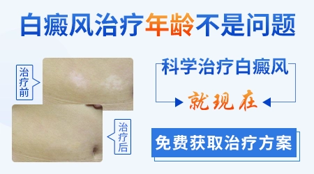 婴儿肛门周围发白图