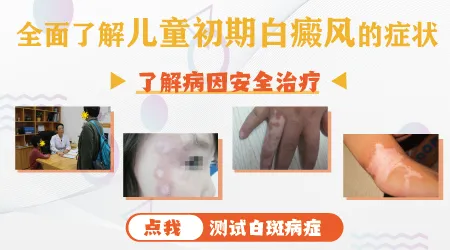 早期儿童白斑识别图片