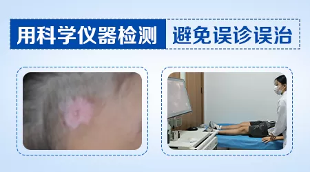 宝宝腿上白斑图片