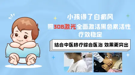 小孩白癜风能不能照308激光