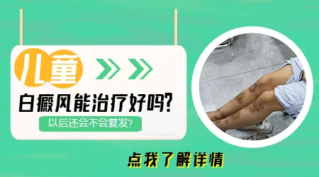 小孩眼皮上一块白癜风怎么治好