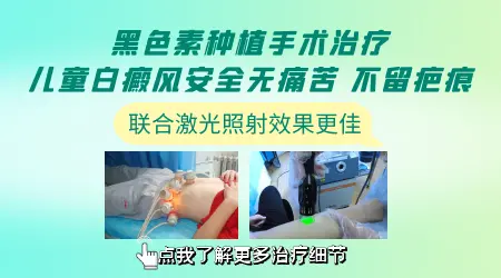 黑色素细胞移植手术适合儿童白癜风吗