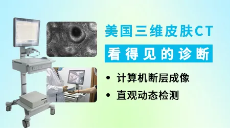 儿童白斑能不能做皮肤CT有辐射吗