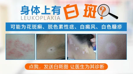 孩子嘴角皮肤变得很白怎么回事