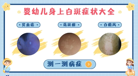 幼儿头上有一片白斑什么原因