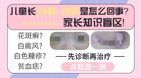 小孩脸上白一块是有蛔虫导致的吗