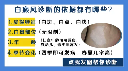 小孩身上有白斑怎么看是不是白癜风