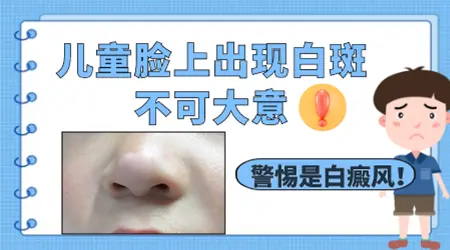 儿童脸上有块白是有寄生虫引起的吗