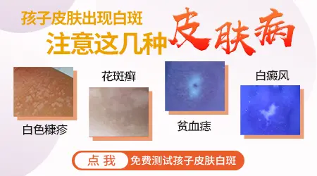小孩皮肤上出现一块白怎么回事