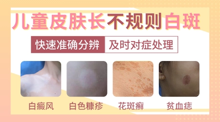 儿童皮肤突然长白斑是什么引起的