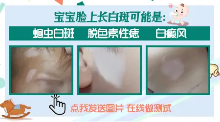 孩子脸上出现白块是不是肚子里有虫