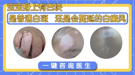 小宝宝皮肤出现白斑可能是什么原因