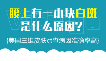 男士腰部白斑检查过吃药涂药治疗不见好