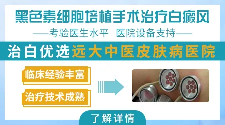 男性白癜风治疗方案 激光治疗白斑好还是手术好