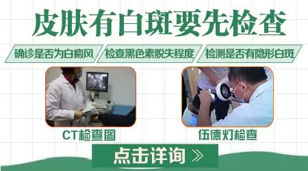 男性生殖器上出现白斑是什么情况