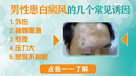 男性手指关节处长白斑是什么问题