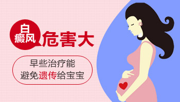 怀孕第一个月长白癜风照激光对小孩有影响吗