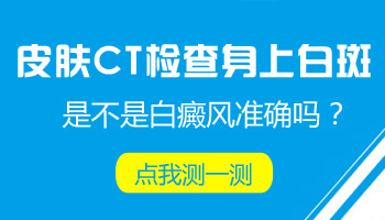 乳房左上方有一块白色皮肤是不是白癜风